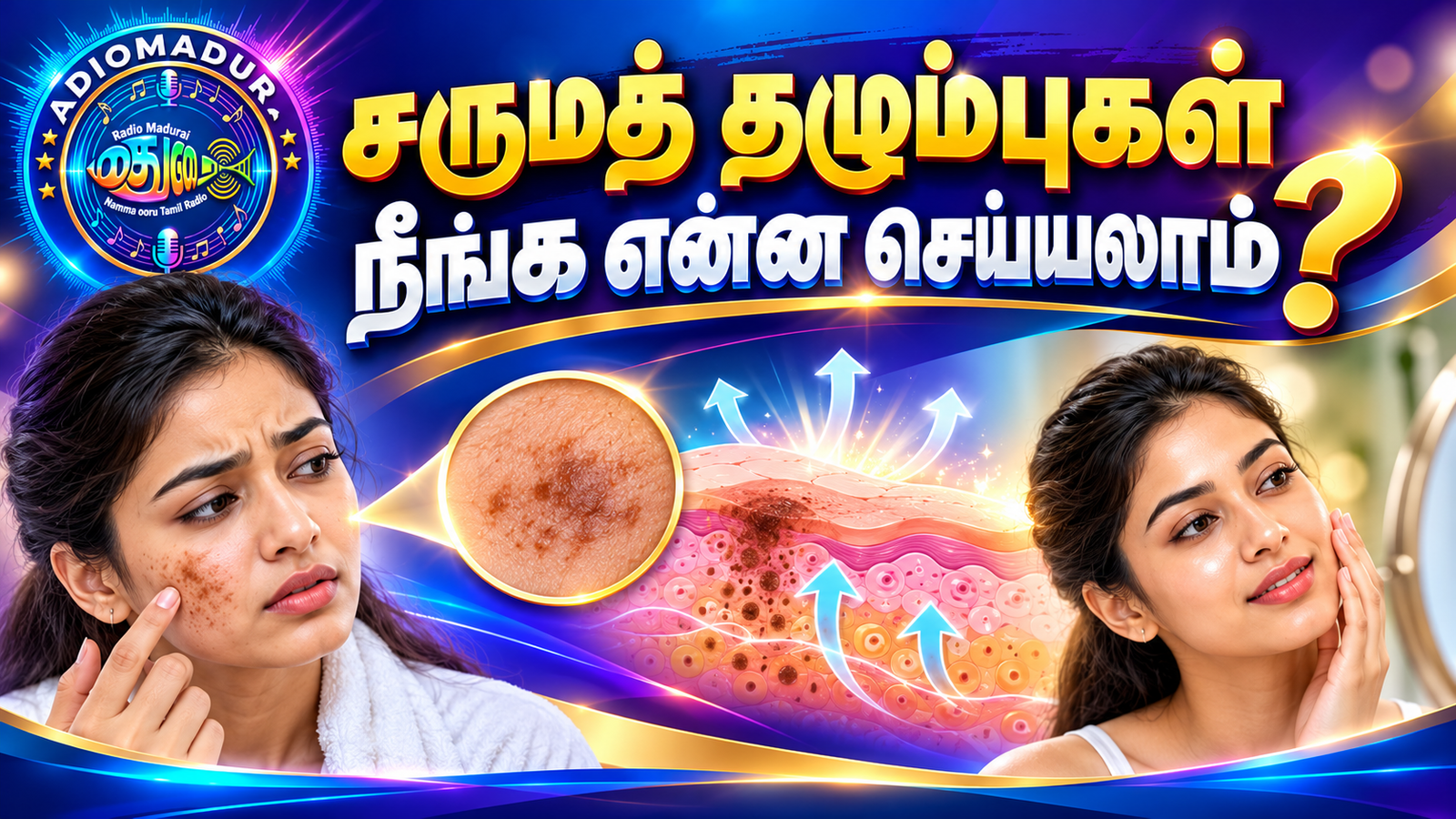 சருமத் தழும்புகள் ஏன் ஏற்படுகின்றன? முகப்பரு வடுக்கள் முதல் பிரசவத் தழும்புகள் வரை – சிகிச்சை முறைகள்